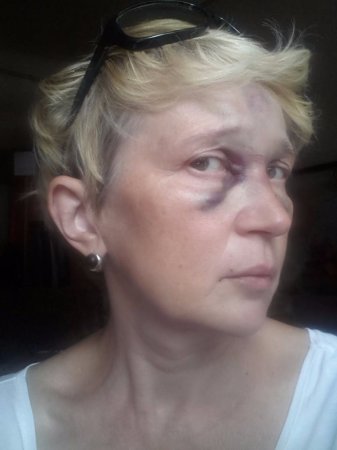 Цивилизованная Цэевропа: в Одессе избита известная журналистка