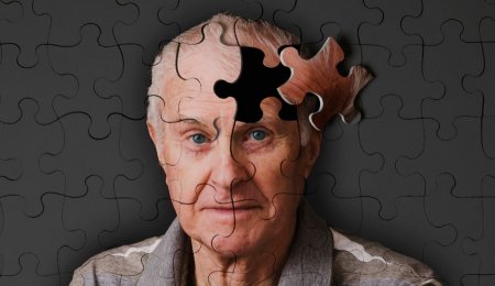 Признаки начала болезни Альцгеймера