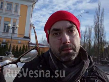 Кулаком в лицо: в Киеве на марше в защиту трансгендеров избили канадского журналиста (ФОТО, ВИДЕО)